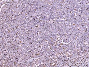 Anti-HLA-DR/HLA-DRA Antibody (monoclonal, 5B13F7)