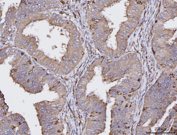 Anti-HLA-DR/HLA-DRA Antibody (monoclonal, 5B13F7)