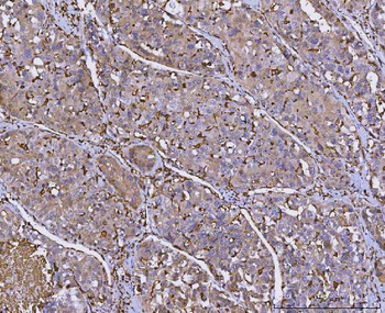 Anti-HLA-DR/HLA-DRA Antibody (monoclonal, 5B13F7)