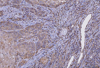 Anti-HLA-DR/HLA-DRA Antibody (monoclonal, 5B13F7)