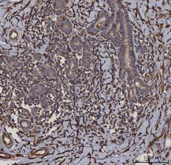 Anti-HLA-DR/HLA-DRA Antibody (monoclonal, 8I10H1)
