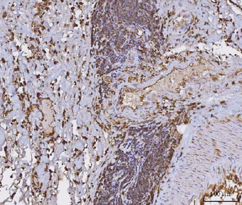 Anti-HLA-DR/HLA-DRA Antibody (monoclonal, 8I10H1)