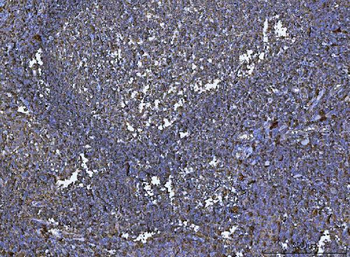 Anti-HLA-DR/HLA-DRA Antibody (monoclonal, 8I10H1)