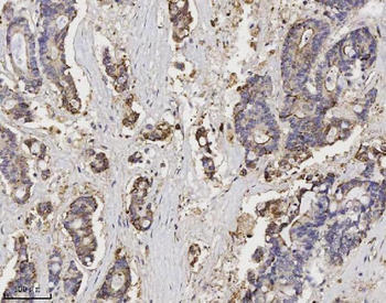 Anti-Annexin A3 Antibody (monoclonal, 2H3H8)