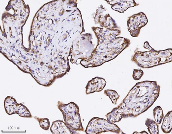 Anti-Annexin A3 Antibody (monoclonal, 2H3H8)