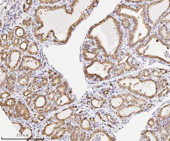 Anti-Annexin A3 Antibody (monoclonal, 2H3H8)
