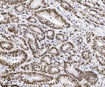 Anti-TRIM24 Antibody (monoclonal, 4G6C2)