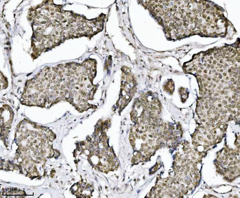 Anti-TRIM24 Antibody (monoclonal, 4G6C2)