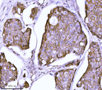 Anti-delta 1 Catenin/CAS/CTNND1 Antibody (monoclonal, 8G7E4)