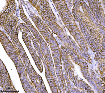 Anti-delta 1 Catenin/CAS/CTNND1 Antibody (monoclonal, 8G7E4)