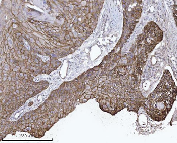 Anti-delta 1 Catenin/CAS/CTNND1 Antibody (monoclonal, 8G7E4)