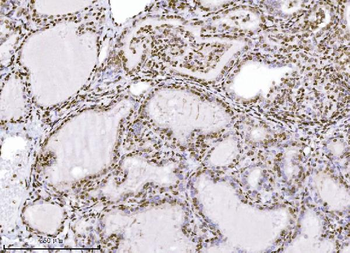 Anti-KPNB1 Antibody (monoclonal, 3I11F2)