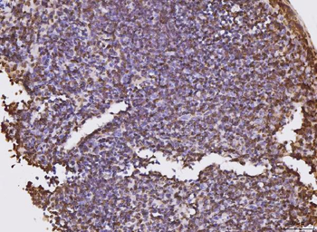 Anti-KPNB1 Antibody (monoclonal, 3I11F2)