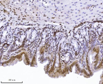 Anti-KPNB1 Antibody (monoclonal, 3I11F2)
