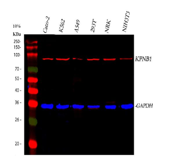 Anti-KPNB1 Antibody (monoclonal, 3I11F2)