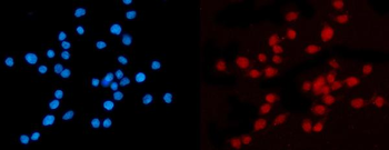 Anti-KPNB1 Antibody (monoclonal, 3I11F2)