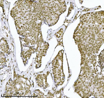 Anti-KPNB1 Antibody (monoclonal, 3I11F2)