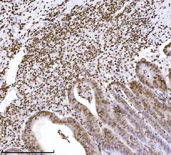 Anti-KPNB1 Antibody (monoclonal, 3I11F2)