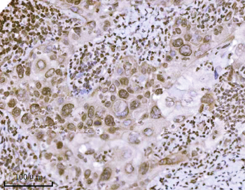 Anti-KPNB1 Antibody (monoclonal, 3I11F2)