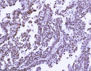 Anti-KPNB1 Antibody (monoclonal, 3I11F2)