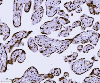 Anti-KPNB1 Antibody (monoclonal, 3I11F2)