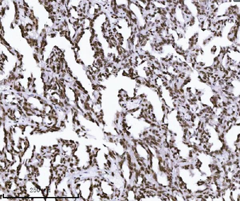 Anti-KPNB1 Antibody (monoclonal, 3I11F2)