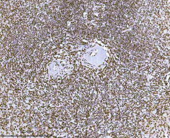 Anti-KPNB1 Antibody (monoclonal, 3I11F2)
