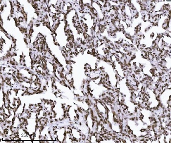 KPNB1 Antibody (monoclonal, 3I11F2)