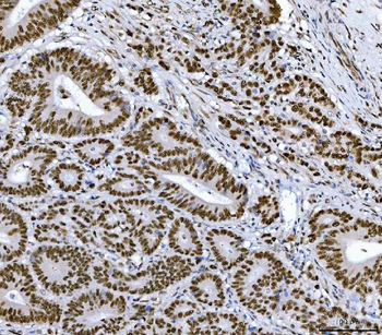 Anti-RCC1 Antibody (monoclonal, 6B11E7)