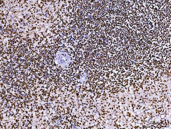 Anti-RCC1 Antibody (monoclonal, 6B11E7)