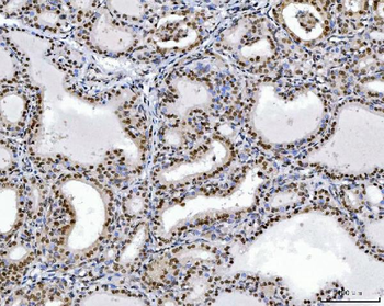 Anti-RCC1 Antibody (monoclonal, 6B11E7)