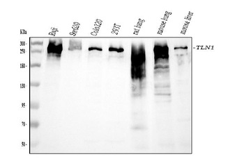 Anti-Talin 1/TLN1 Antibody (monoclonal, 2G10D2)