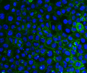Anti-Integrin beta 4/ITGB4 Antibody (monoclonal, 7G10D2)