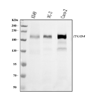 Anti-Integrin beta 4/ITGB4 Antibody (monoclonal, 7G10D2)