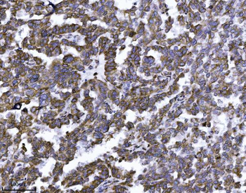Anti-Erlin-2/ERLIN2 Antibody (monoclonal, 3H9A2)