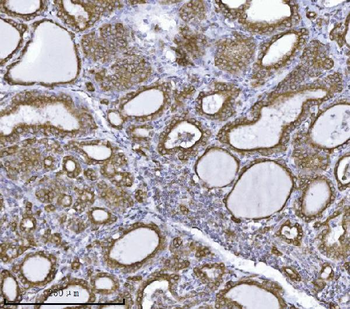 Anti-Erlin-2/ERLIN2 Antibody (monoclonal, 3H9A2)