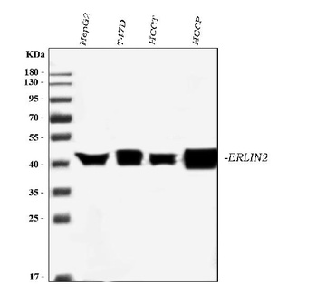 Erlin-2/ERLIN2 Antibody (monoclonal, 3H9A2)