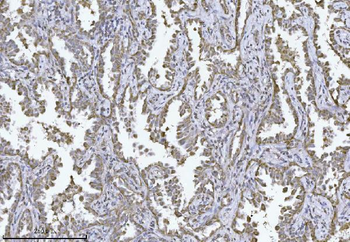 Anti-MPPB/PMPCB Antibody (monoclonal, 9F13E4)