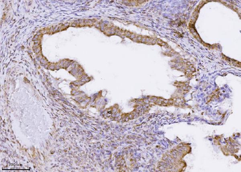 Anti-MPPB/PMPCB Antibody (monoclonal, 9F13E4)