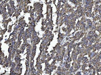 Anti-Drebrin/DBN1 Antibody (monoclonal, 4F6E7)
