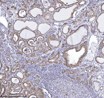 Anti-Drebrin/DBN1 Antibody (monoclonal, 4F6E7)