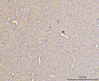 Anti-Drebrin/DBN1 Antibody (monoclonal, 4F6E7)