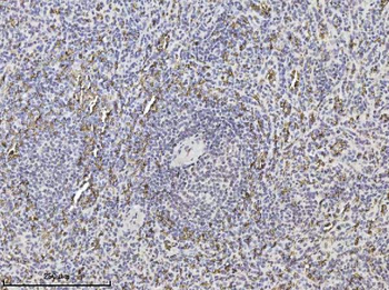 Anti-SLC4A1/CD233/Band 3 Antibody (monoclonal, 5G2G7)