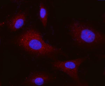 Integrin alpha V/ITGAV Antibody (monoclonal, 8B10H2)