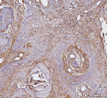 Anti-Integrin alpha V/ITGAV Antibody (monoclonal, 8B10H2)