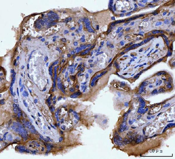 Anti-Integrin alpha V/ITGAV Antibody (monoclonal, 8B10H2)