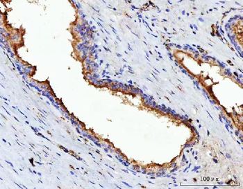 Anti-VPAC2/VIPR2 Antibody