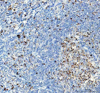 Anti-VPAC2/VIPR2 Antibody
