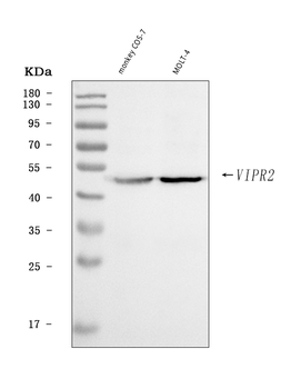 Anti-VPAC2/VIPR2 Antibody