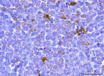 Anti-TFEB Antibody